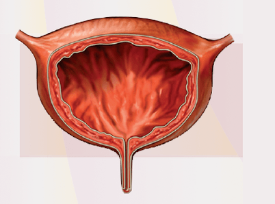 Signs of cystitis