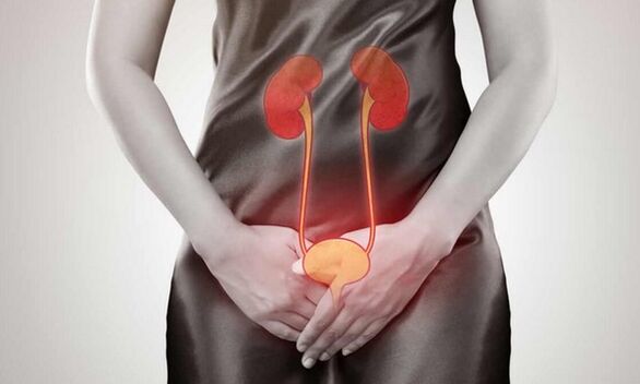 Causes and treatment of cystitis in women