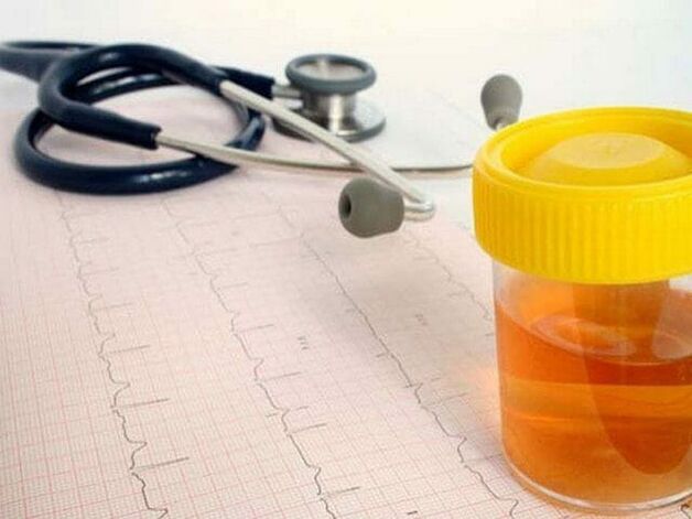 Urinalysis to diagnose cystitis