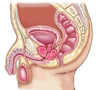 Causes of cystitis in men